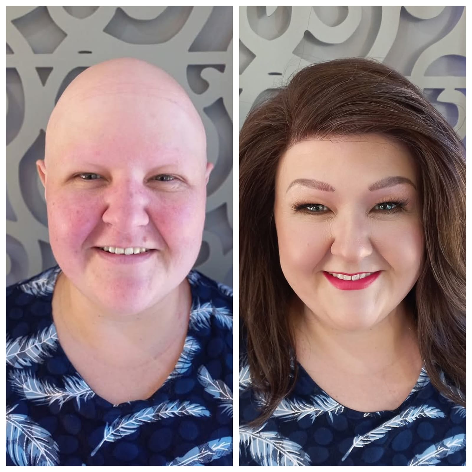 Before & After 6